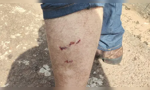 Multa de R$ 3,4 mil aplicada a tutor após ataque de cachorro em Arapongas