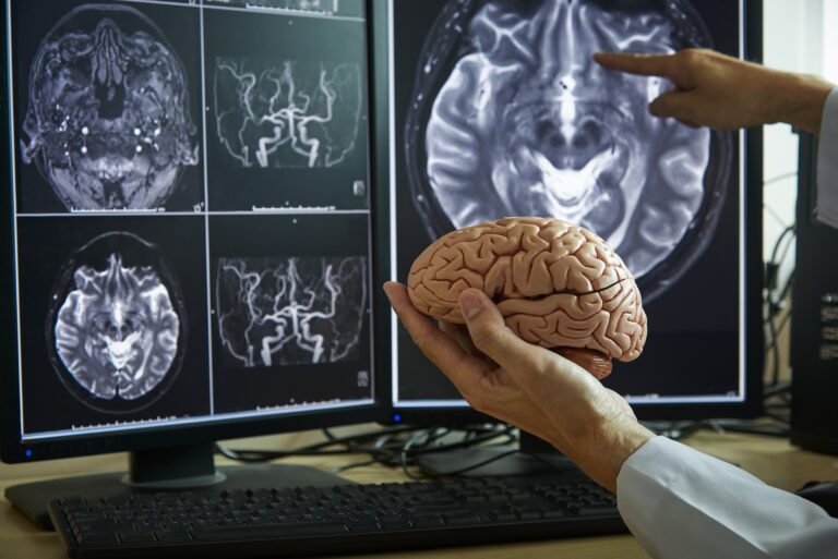 Como o cérebro envelhece: estudo revela novas perspectivas sobre Alzheimer e Parkinson
