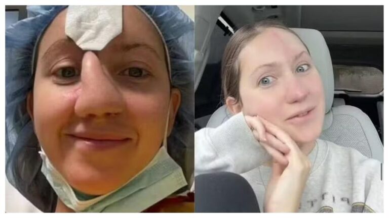 Mulher se recupera após ataque de cão e mostra novo rosto