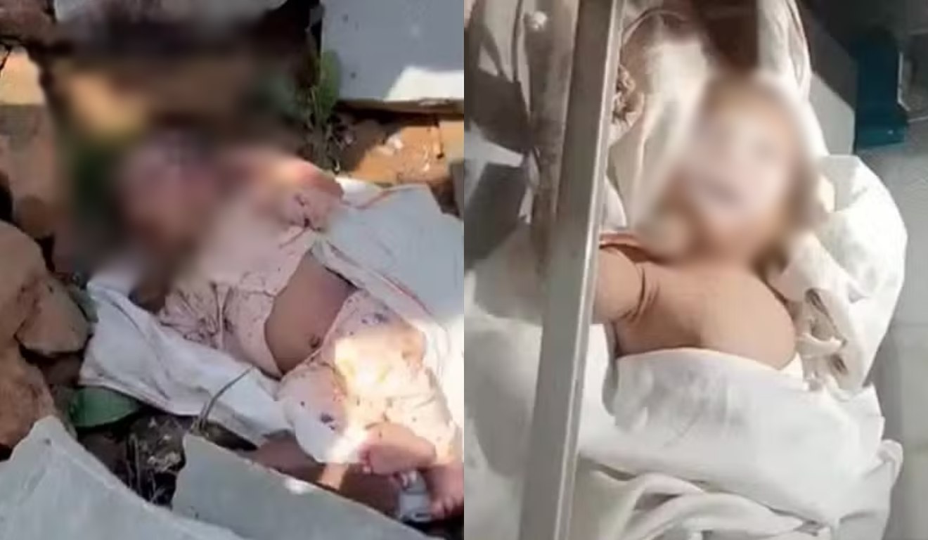 Bebê abandonado em matagal é resgatado com pedra na boca