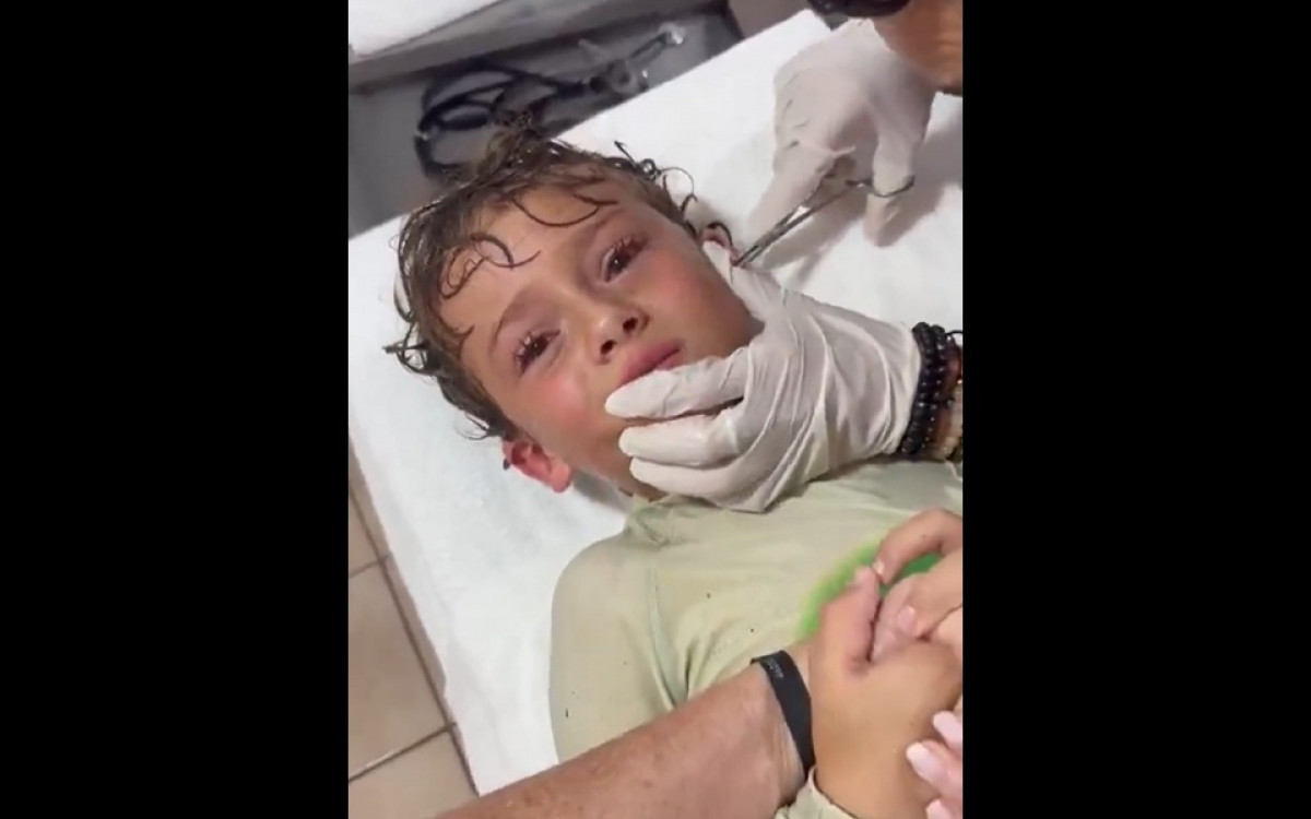 Susto no Mar: Caranguejo Vivo Surpreende ao se Alojar no Ouvido de Filho de Influenciadora