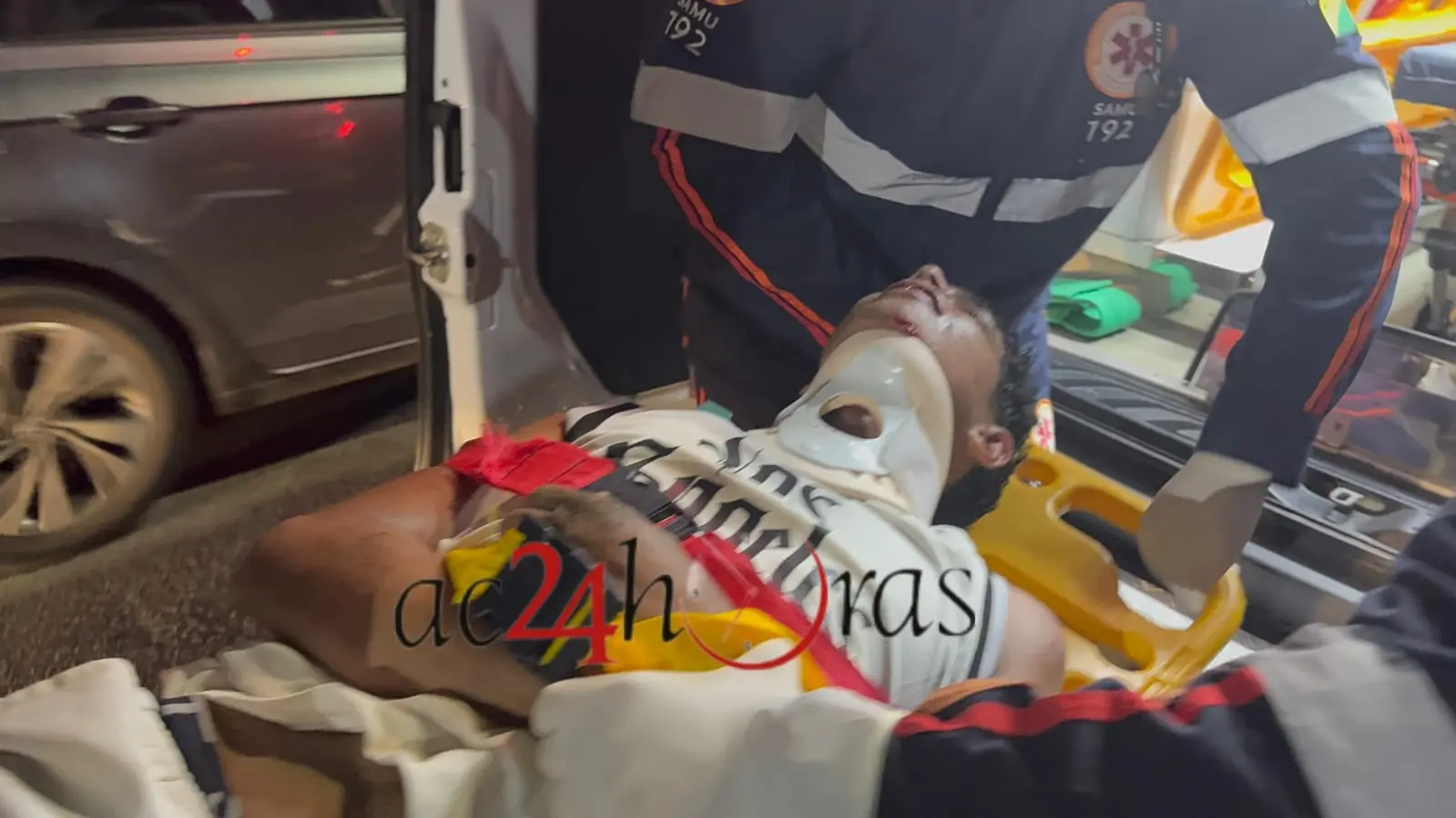 Jovem de 18 anos Fica Ferido Após Colisão com Poste em Rio Branco; Consumo de Álcool e Drogas é Apurado