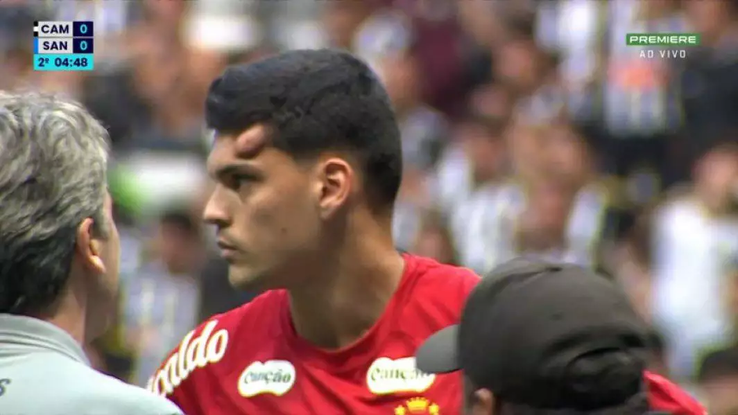 Susto no Brasileirão: Goleiro do Santos, Gabriel Brazão, Deixa o Campo de Ambulância Após Choque em Partida Contra o Atlético-MG