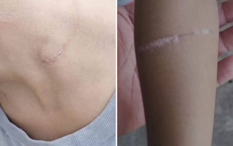Pai é preso suspeito de tortura contra os filhos de 7 e 8 anos