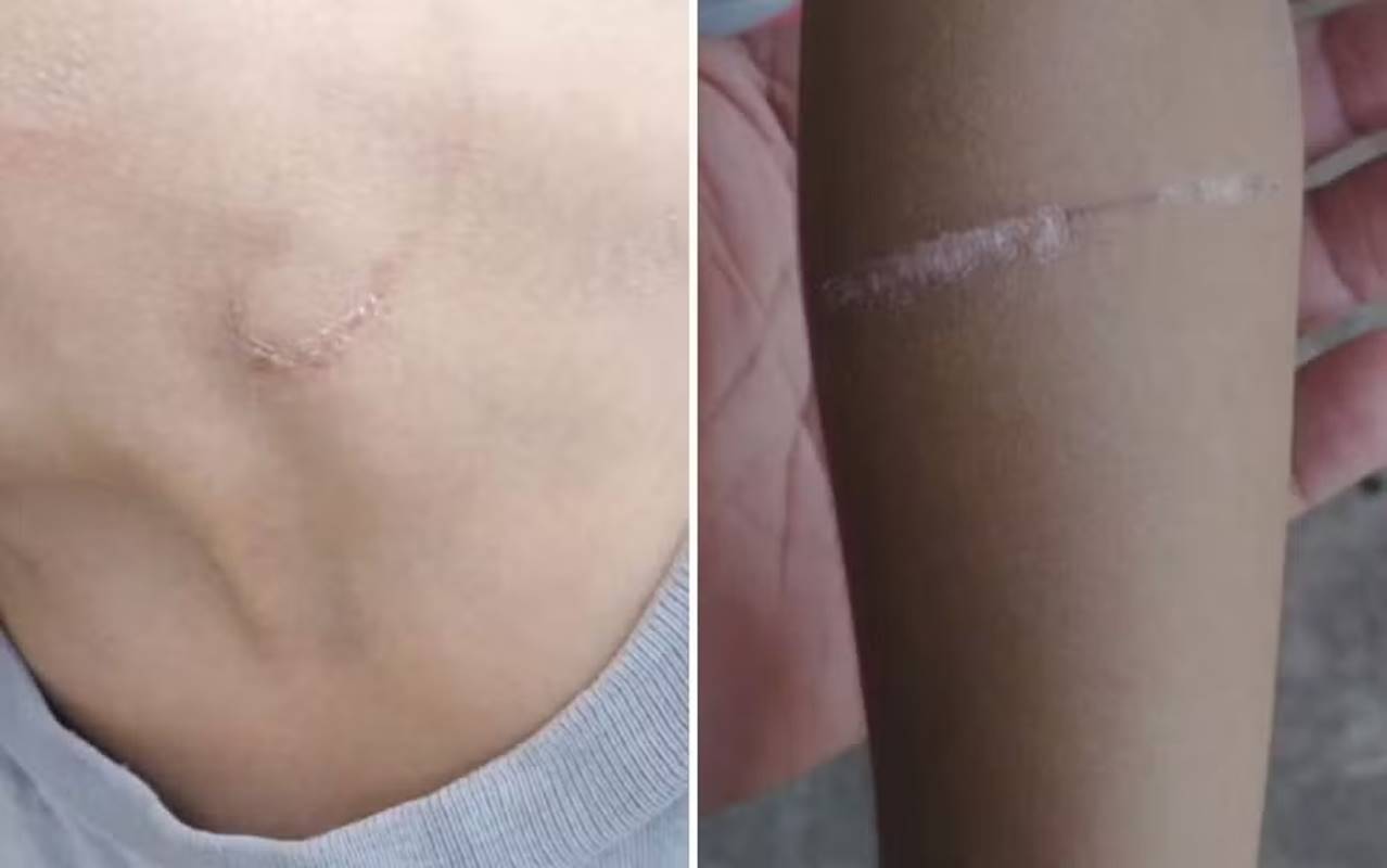 Pai é preso suspeito de tortura contra os filhos de 7 e 8 anos