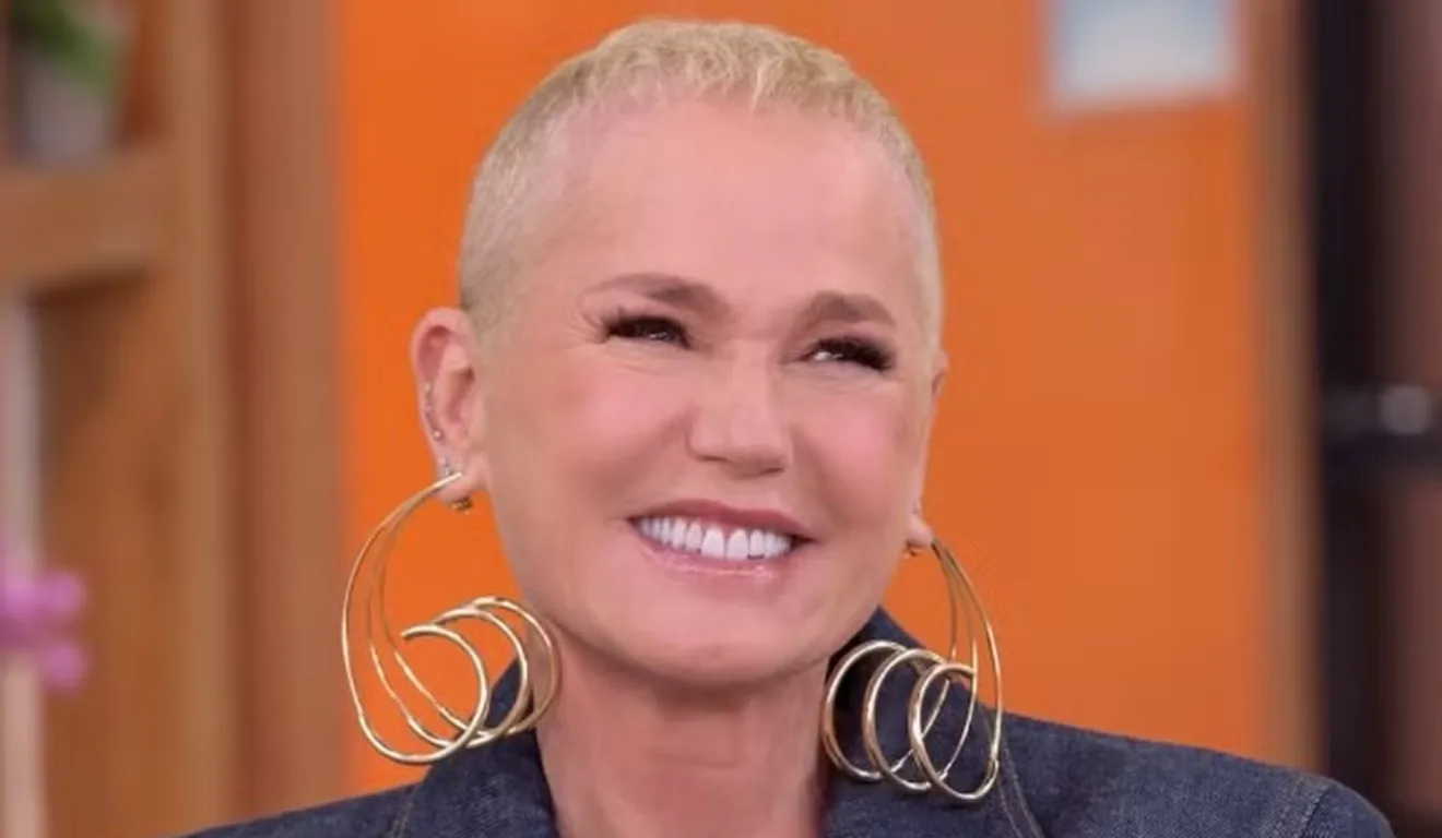 Xuxa Revela Resultado de Transplante Capilar e Alerta para a Alopecia Feminina: Entenda o Procedimento
