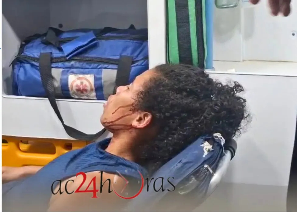 Ataque brutal: Homem invade casa da ex e a esfaqueia com canivete em Rio Branco