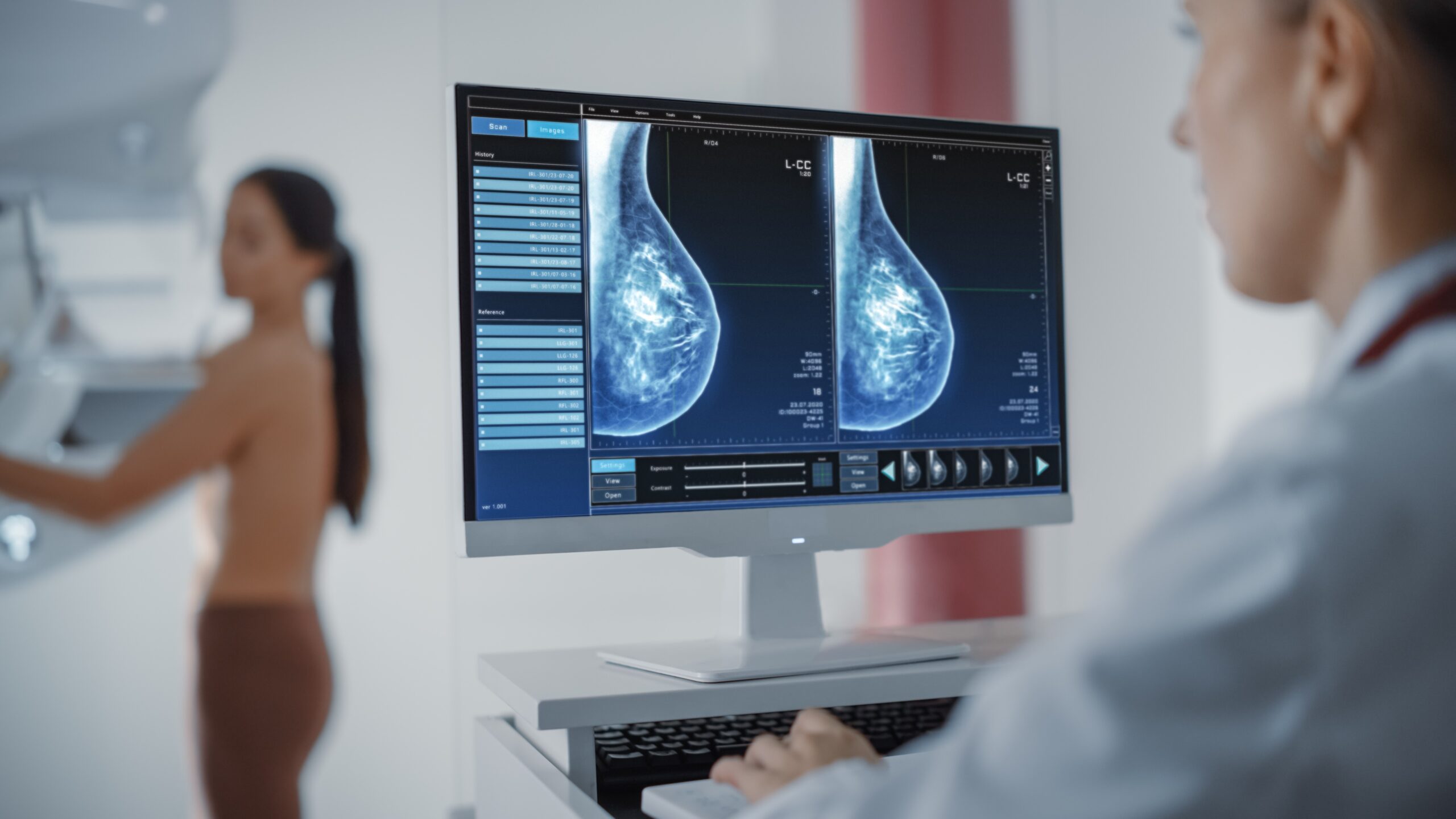 SUS realiza 1,7 mil atendimentos de pacientes com câncer de mama por ano no Vale