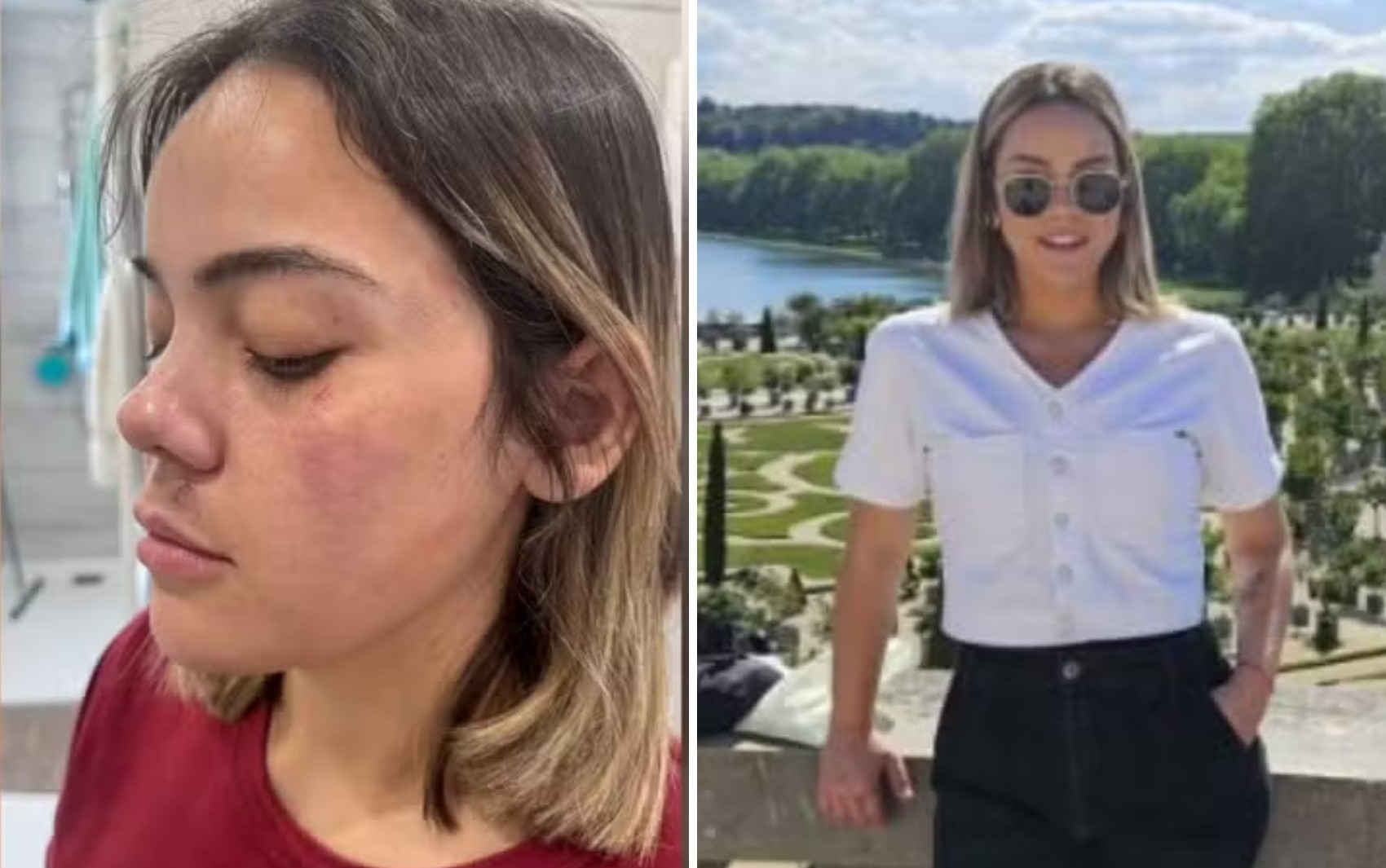 Mulher que defendeu brasileira em tentativa de estupro em Paris relata o caso