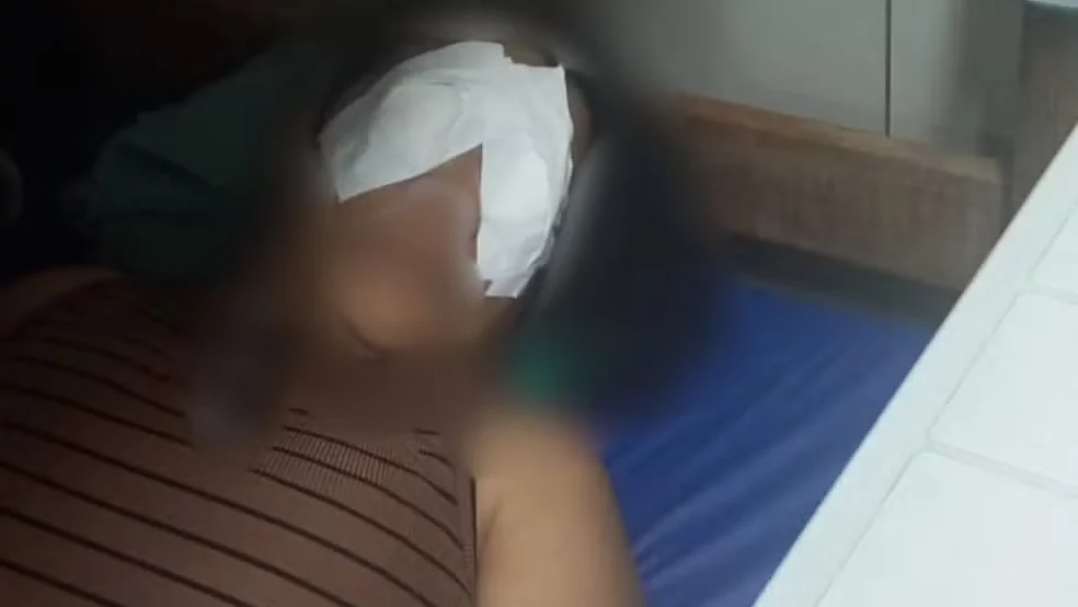 Técnica de Enfermagem Sofre Queimadura na Córnea por Vapores Tóxicos em Hospital de Natal