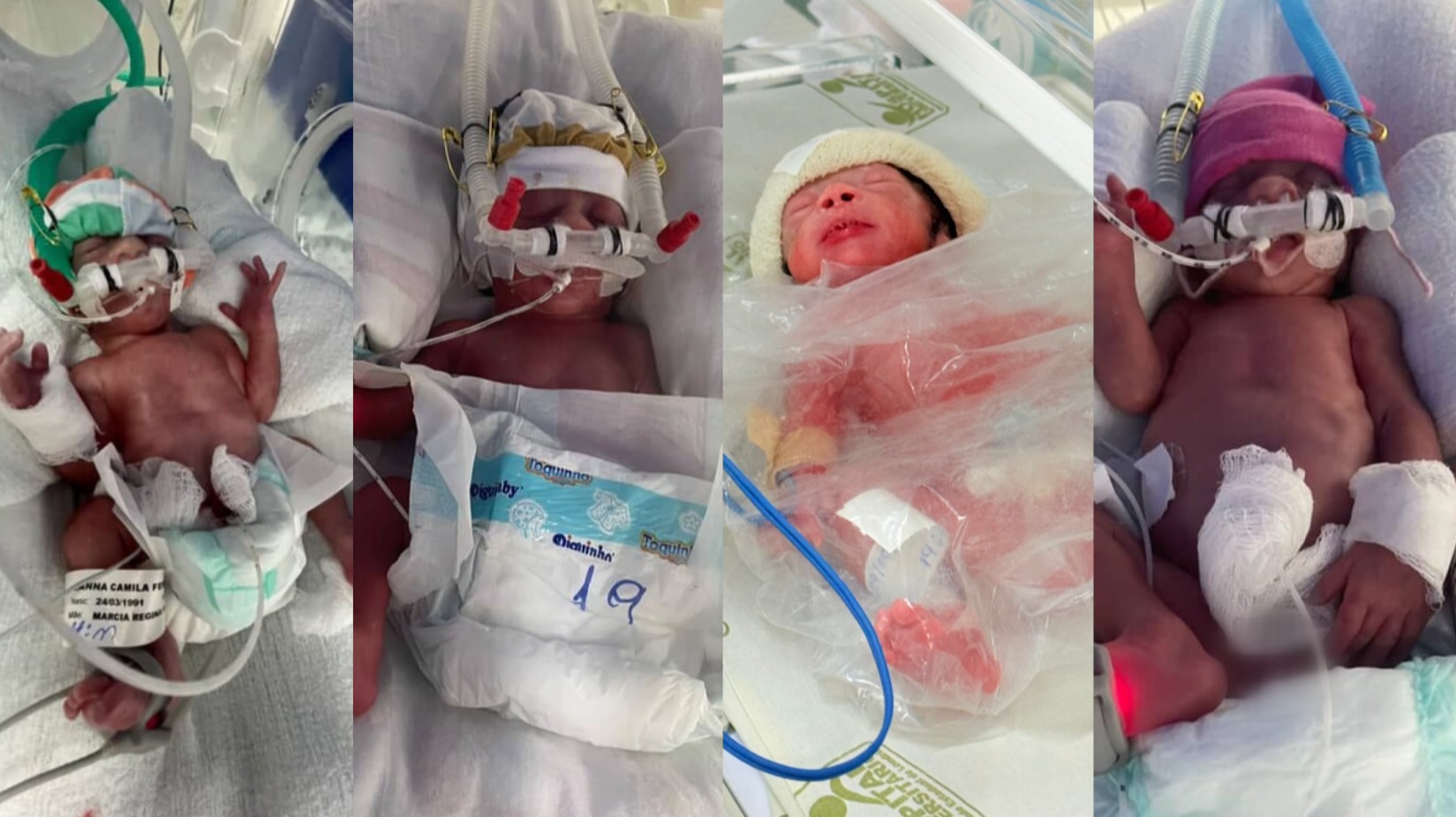 Quadrigêmeos nascem no Paraná após quatro anos de tentativas do casal
