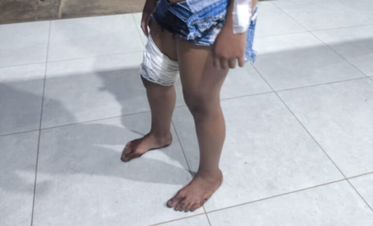 Adolescente esfaqueada durante festa em Buritis, MG