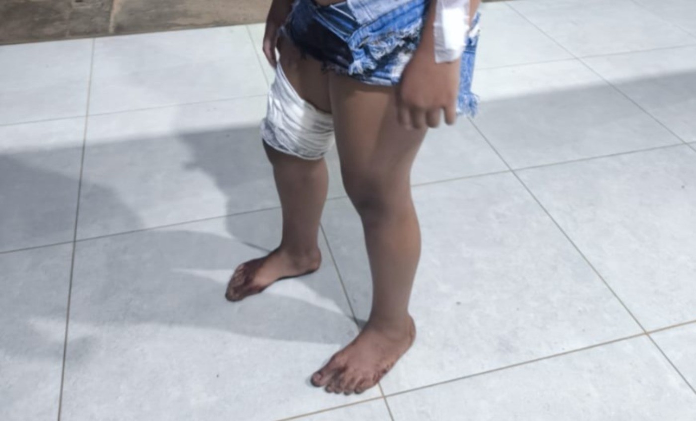 Adolescente esfaqueada durante festa em Buritis, MG