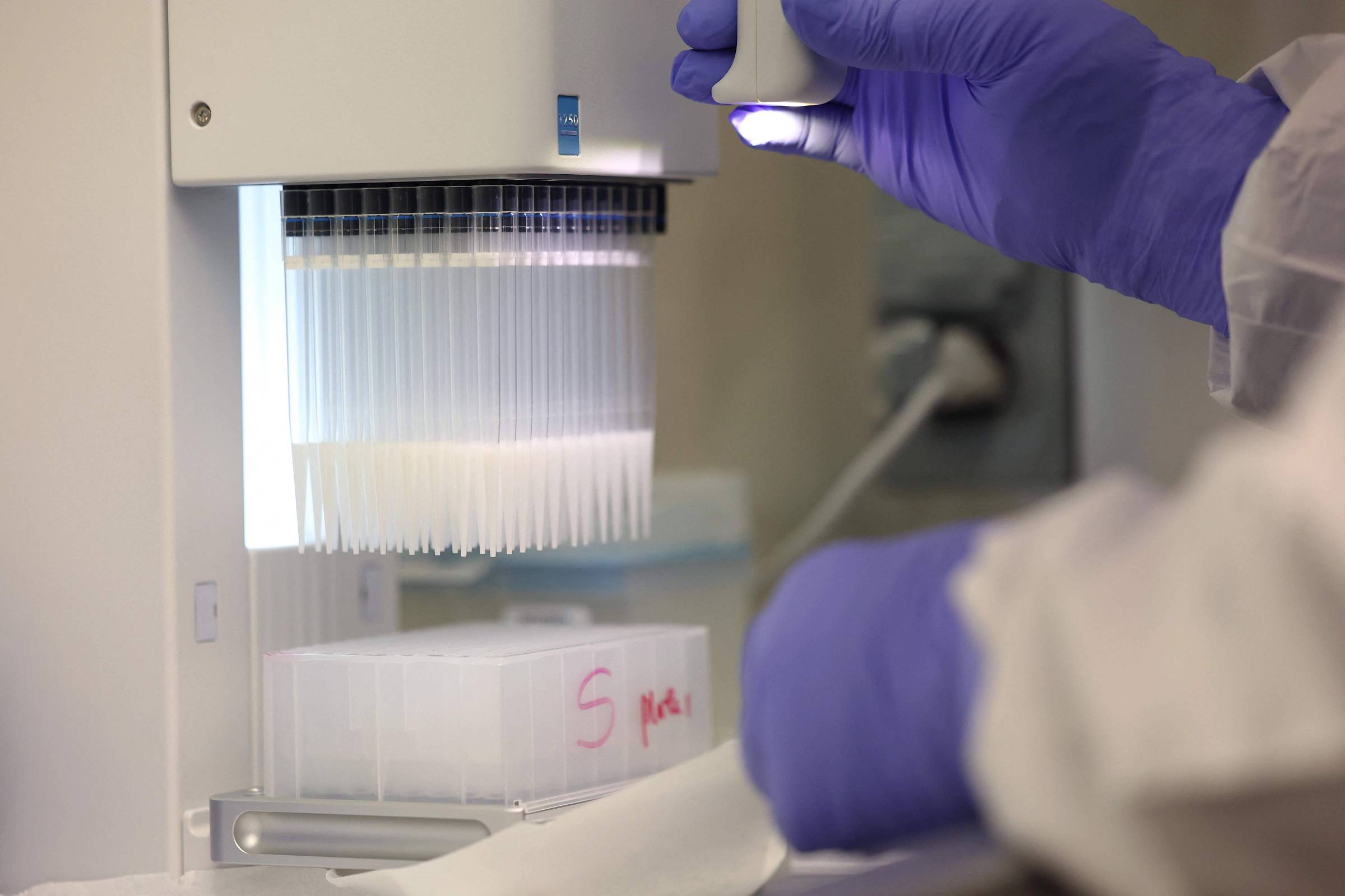 Primeiro caso de gripe aviária em Washington resulta em morte