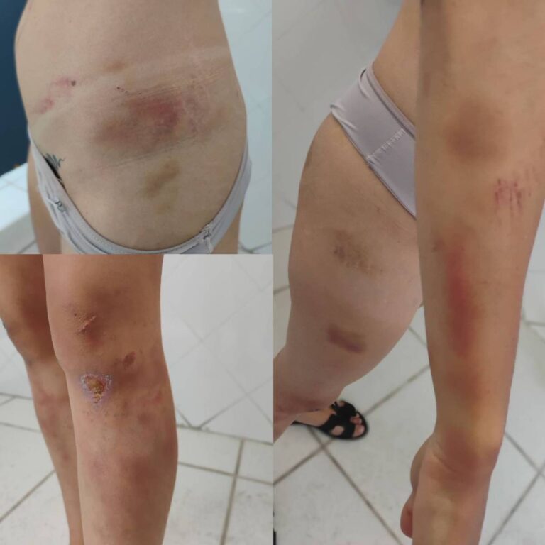 Mulher é detida no Rio por tentativa de feminicídio contra ex-companheira