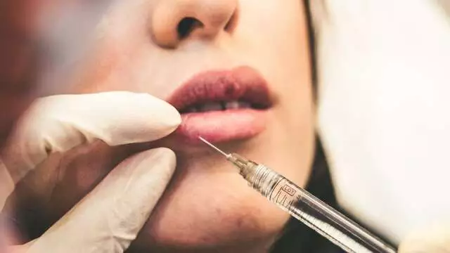 Alerta de Saúde: Uso Inadequado de Botox Eleva Casos de Paralisia no Brasil
