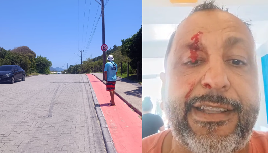 Motorista de Aplicativo Brutalmente Agredido na Joaquina por Recusar Pagamento de Estacionamento Ilegal