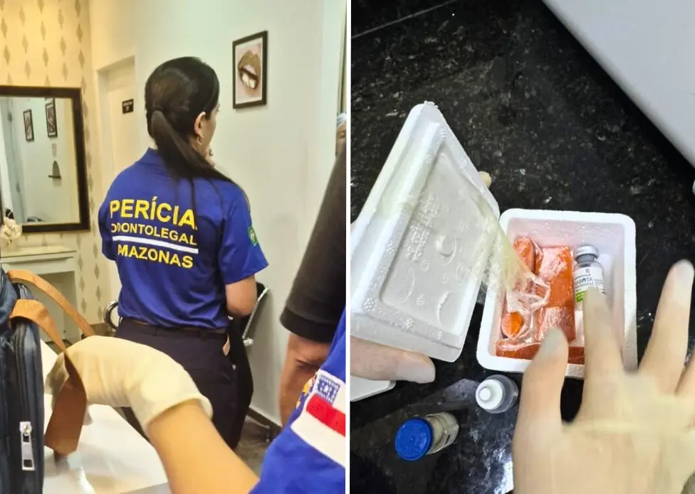 Dentista é Preso em Manaus Acusado de Sedar Pacientes e Desviar Fundos