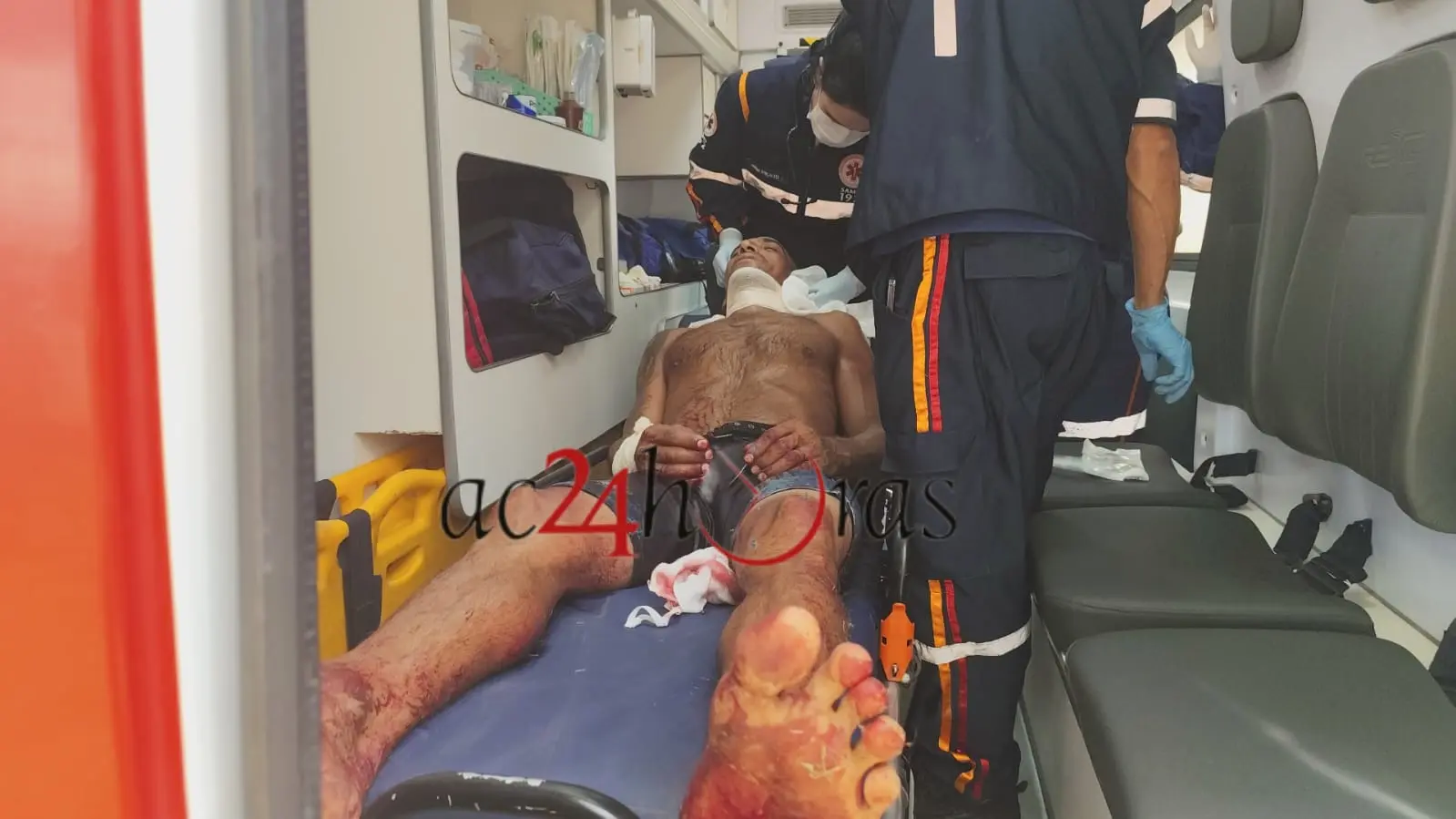 Violência em Rio Branco: Homem é brutalmente atacado a golpes de terçado no Belo Jardim II