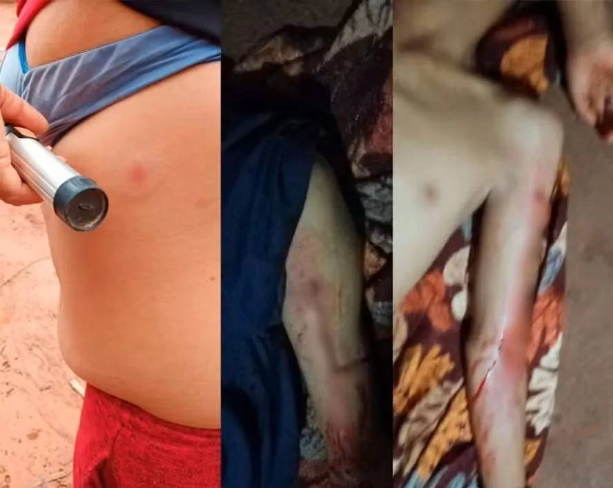 Ataque Brutal a Indígenas Guarani Kaiowá Deixa Morto e Feridos no Mato Grosso do Sul