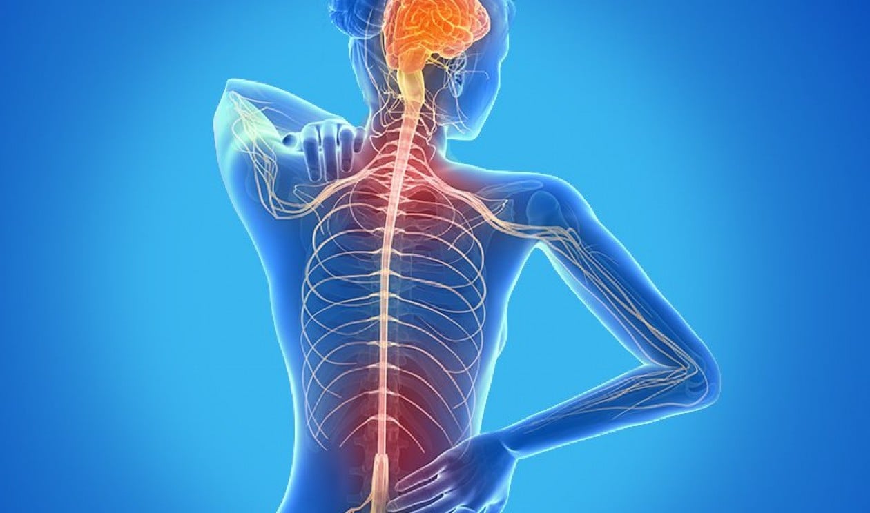 Esclerose Múltipla: Entenda a Doença Autoimune que Ataca o Sistema Nervoso