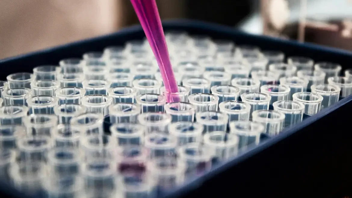 Inflamação Cerebral Revelada como Peça-Chave no Desenvolvimento do Alzheimer, Aponta Estudo