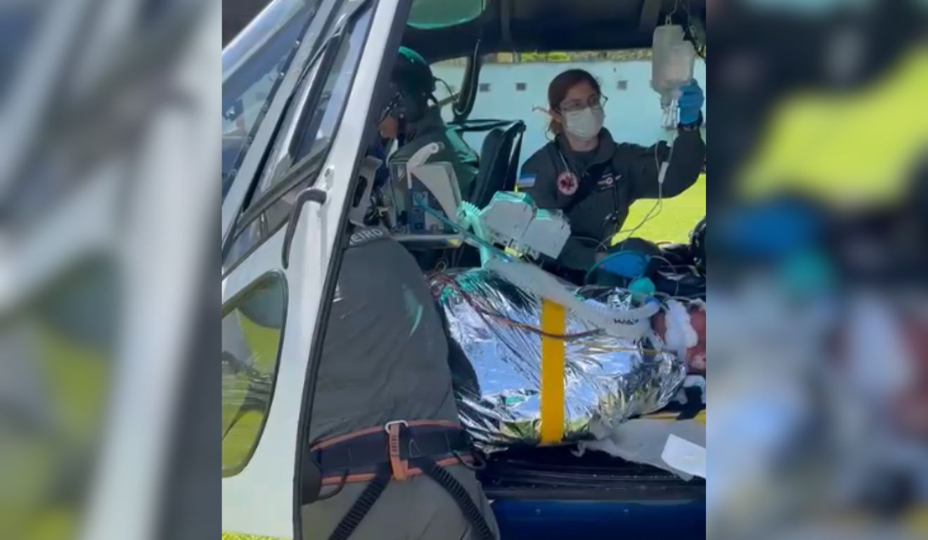 Imprudência no Churrasco: Homem Sofre Queimaduras Graves ao Usar Thinner para Acender Churrasqueira no ES