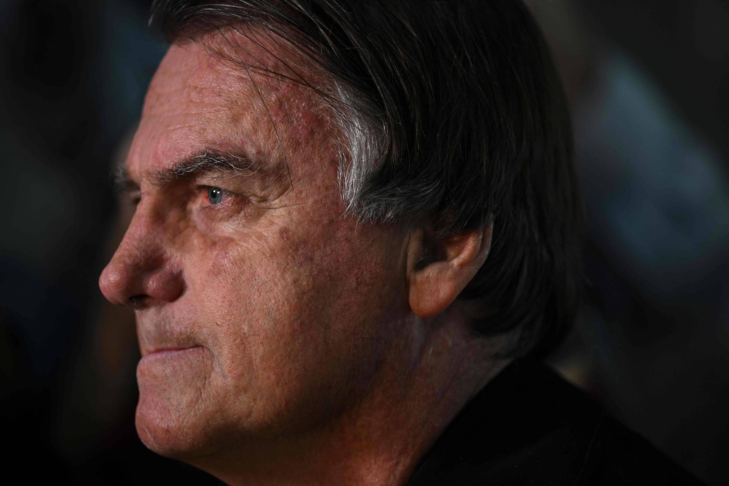 Bolsonaro passa por novo procedimento para conter crises de soluço crônico