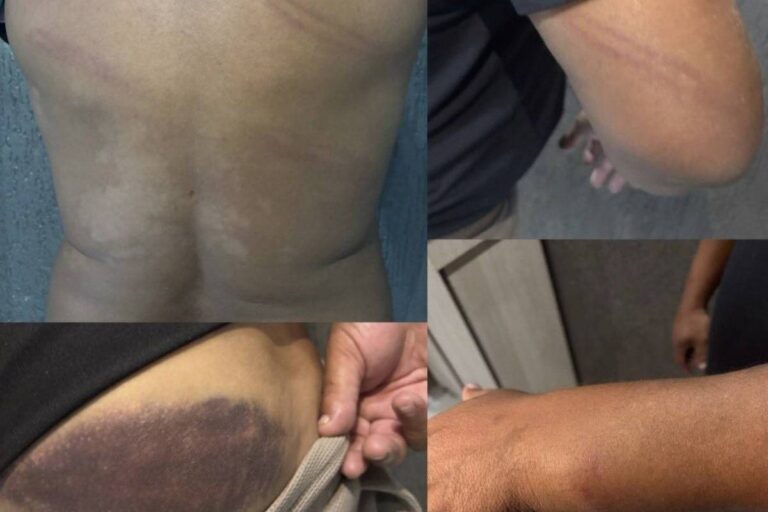 Ex-jogador Perdigão sofre agressão por policial militar em Curitiba